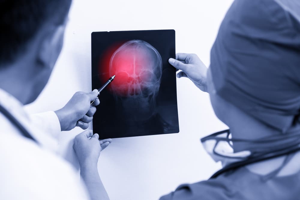 Doctor and surgeon reviewing a patient's head X-ray for potential brain, skull, or eye injuries, highlighting medical diagnosis and treatment.