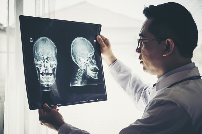 A doctor looks at the scans for a pedestrian accident victim